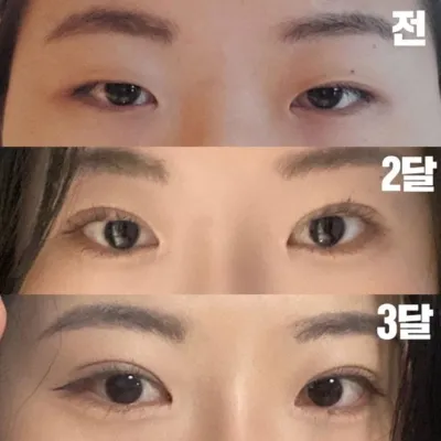 3 сар болчихлоо, үнэхээр гайхалтай харагдаж байна