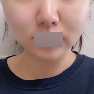 Шим Жонг Хван эмчийн гарын хүрэлцэмж маш нарийн мэдрэмжтэй юм шиг байна.