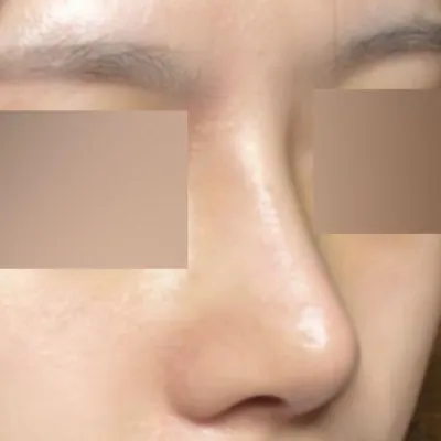 Анхны мэс засал боловч амжилттай болсон мэдрэмж илүү байна