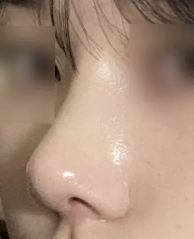 Нүүрний харьцаанд тохирсон хамар хийлгэх талаар зөвлөж байсан нь ялангуяа таалагдсан.