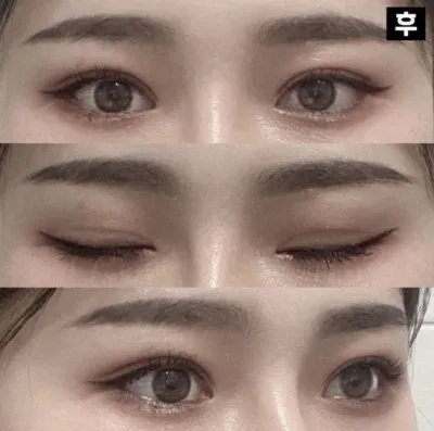 Мэс заслын өмнөхөөс илүү царайлаг болсондоо сэтгэл хангалуун байна!