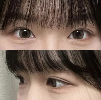 Намайг маш сайн зөвлөсөн тул би Weaver Plastic Surgery-д хагалгаа хийлгэхээр шийдсэн!