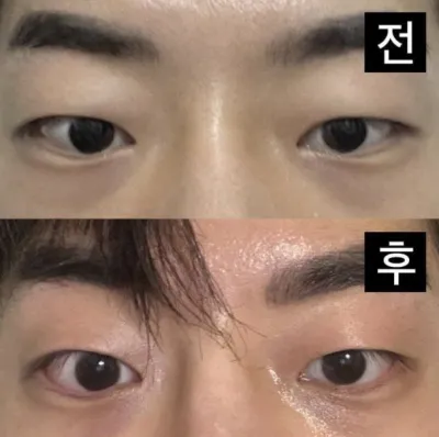 Зөвхөн нүд гэлтгүй хамар ч бас маш амжилттай болсон