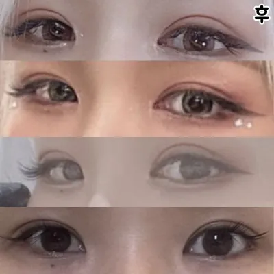 Инээхэд байхгүй байсан зовхины өөх үүссэн!!!!!!!Баярлалаа!!!!