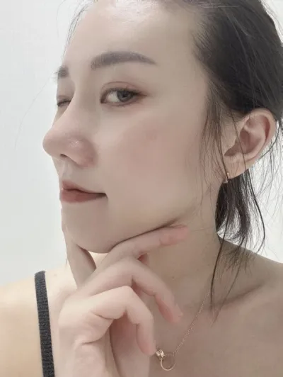 Хамрын анхны мэс засал иймэрхүү бол амжилттай гэж үзэхгүй гэж үү?