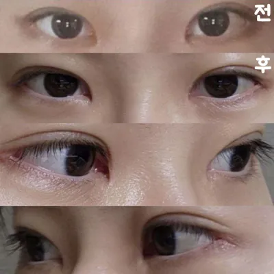 Илүү дээр, хариугүй мэдрэмж алга болж, сэрүүн харагдаж байгаа тул би маш их сэтгэл хангалуун байна!