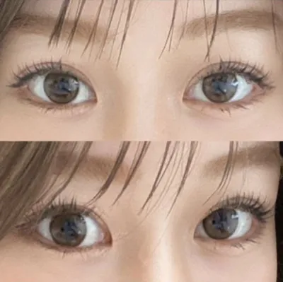 Хэт их эмчилгээ байхгүй, мэс засал хийсний дараа ч бүрэн сайн халамжилдаг шүүㅎㅎㅎ