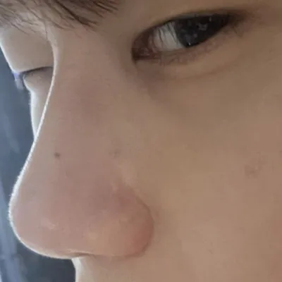 Мэс засал хийлгэсэндээ маш их баярлаж байна, баярлалаа