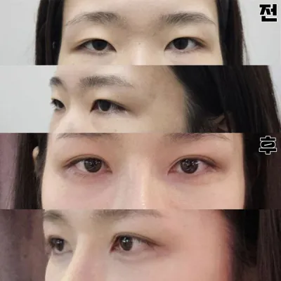 Үнэхээр нимгэн, байгалийн шугамтай сайн болгодог