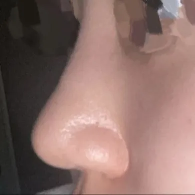 Маш сайн байнаа ㅠㅠㅠ Баярлалаа эмч ээ..