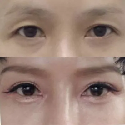 Хавагнах нь тэр дороо буурч, сайн болсон юм шиг байна