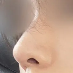 Хамрын мэс засал хийлгэсэн гэж мэдээгүй, маш байгалийн харагддаг гэж хүмүүс их хэлдэг.