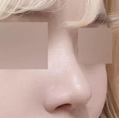 Хэрэв эмчид итгэх итгэл байхгүй бол хийлгэхгүй байсан байх даа kk