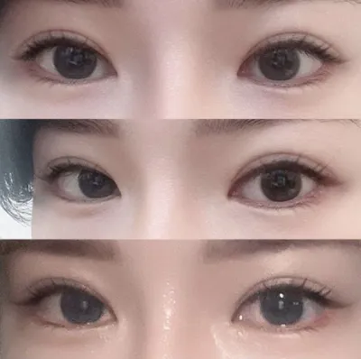 Хэрэв дахин мэс засал хийлгэх шаардлагатай бол бүгдээрээ Weverse-д очоорой!! ккк