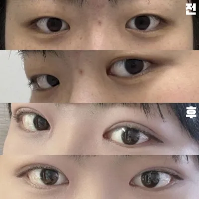 Өвдөлтгүйгээр нарийн хийж өгсөнд баярлалаа.