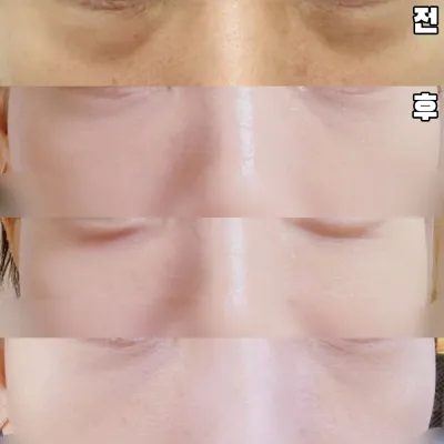 Цаг хугацаа өнгөрөх тусам илүү дээрдэхийг хүлээж байна.