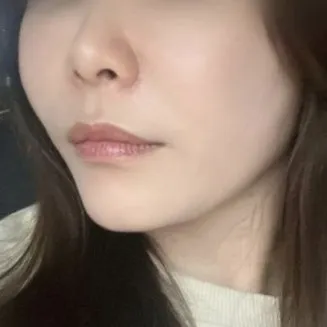 Зөвхөн тоорын өргөлт хийлгэсэн чинь царай чанга болчихлоо шүү дээ хэхэ