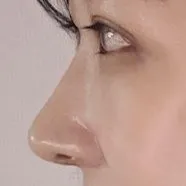 Гоё нүд, хамар хийлгэсэнд баярлалаа