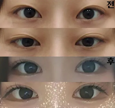 Эмч нь ч бас эелдэг хандсанд би шууд энд шийдвэрээ гаргасан!!