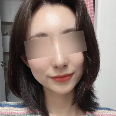 Хамрын + духны өөх шилжүүлэн суулгуулах мэс засал хийлгэсэн!!