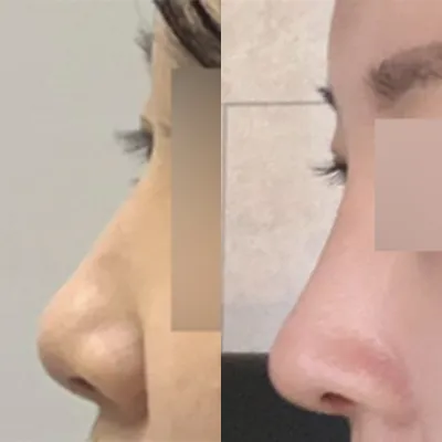 Хамрын анхны мэс засал хийлгэлээ!