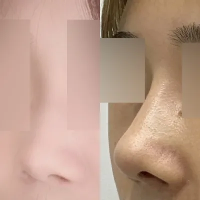 Мэс заслын дараа өөртөө итгэх итгэлтэй болсон