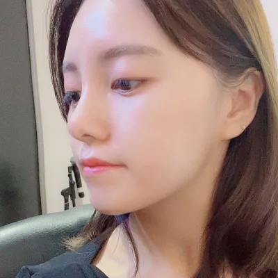 Виверс гоо сайхан мэс засал хийлгэснээс хойш 1 сар болж байна