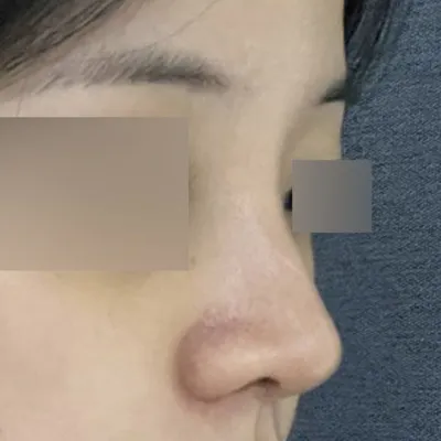 Мэс засал хийлгэснээс хойш 2 долоо хоног болж байна