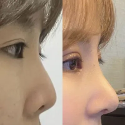 Хамрын дахин мэс заслыг Со захирал, нүдний дахин мэс заслыг Шим захиралд хийлгэсэн