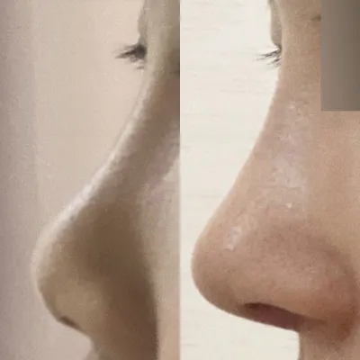 Би Сим Жон Хван эмчид хагалгаа хийлгэснээс хойш 2 долоо хоног болж байна.