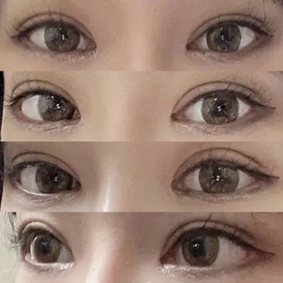 Би нүдний хэлбэрээ засуулсан!