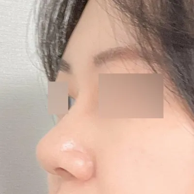 Мэс заслын дараах 3 сарын тойм