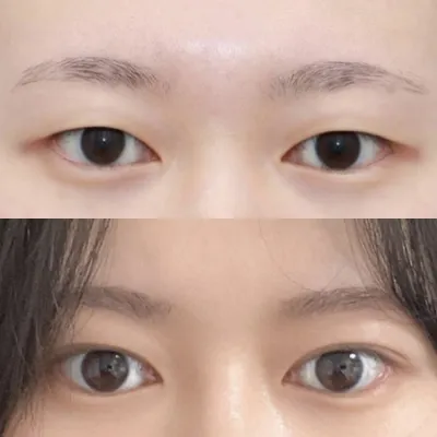 Мэс заслын дараах 3 сарын тойм