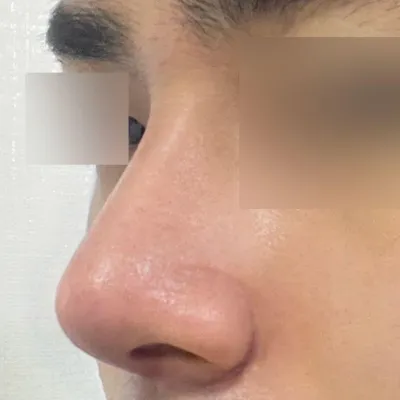 Виверс гоо сайхны мэс заслын эмнэлэгт хагалгаанд ороод 2 долоо хоног болж байна.