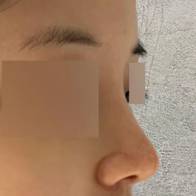 Мэс засал хийлгээд хоёр сар болж байна