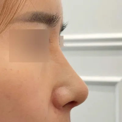 Үнэхээр гоё сайхан хагалгаа боллоо^^