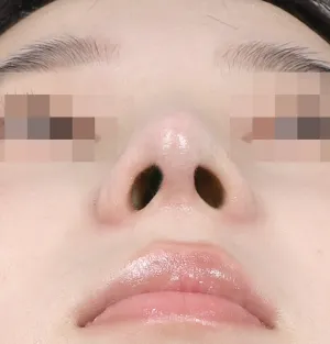 After