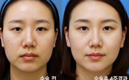 🌸 Хоёр зовхины мэс засал - таны гоо сайханд зориулсан шийдэл 🌸