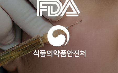 Арьс сэргээгч тарилгын үр нөлөө ба төрлүүд 2024 | Режуран·Жувидерм Волайт харьцуулалт - Юверс гоо сайхны эмнэлэг