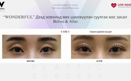 Your Wonderful Change! With Re Beauty Mongolia  "Wonderful"  Гоо сайхны мэс заслын эмнэлэг