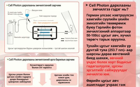 Cell Photon дархлааны эмчилгээ ( UVBT: UV цусны эмчилгээ )  CHA Medical center
