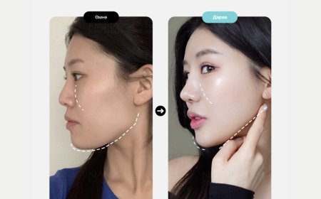 Нүүрний хэлбэр засах мэс заслын бодит үр дүн