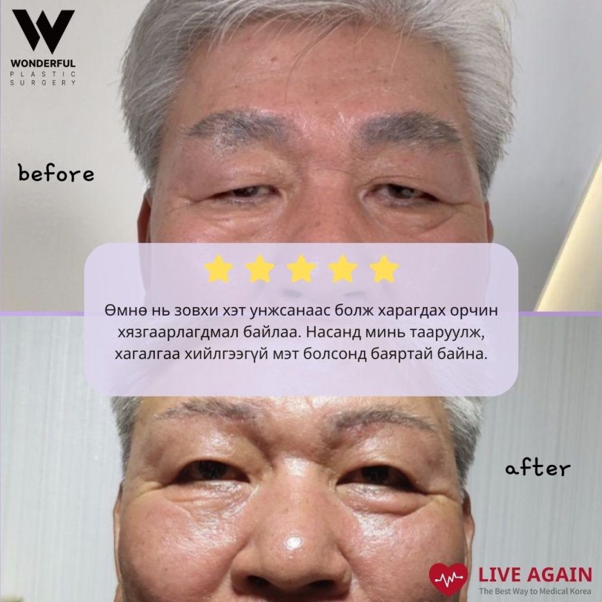 "Wonderful" Гоо сайхны мэс заслын эмнэлэг Before & After