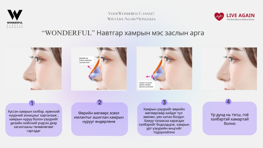 "Wonderful"  Гоо сайхны мэс заслын эмнэлэг   Хамрын мэс засал