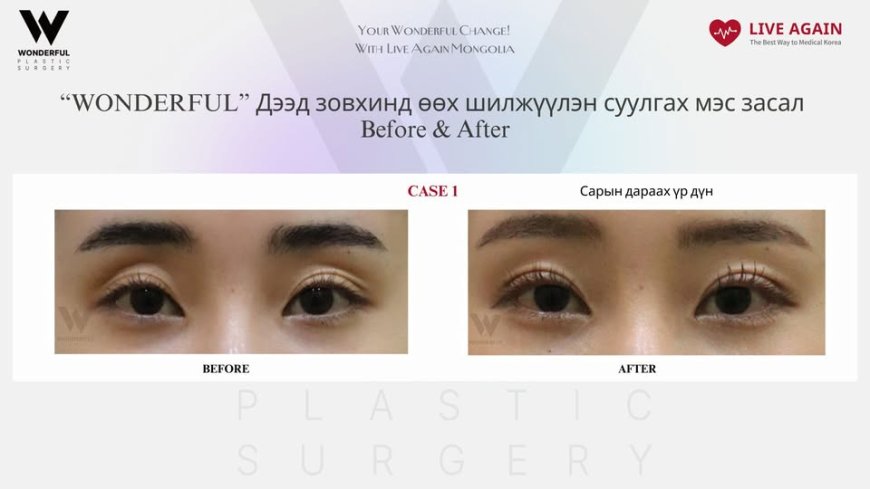 Your Wonderful Change! With Re Beauty Mongolia "Wonderful" Гоо сайхны мэс заслын эмнэлэг