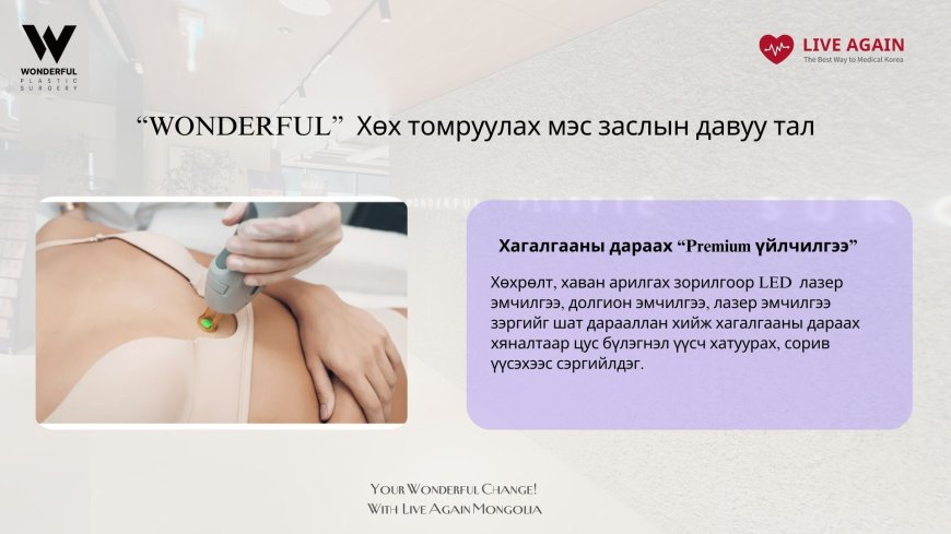 "Wonderful"  Гоо сайхны мэс заслын эмнэлэг "Хөх томруулах мэс засал"