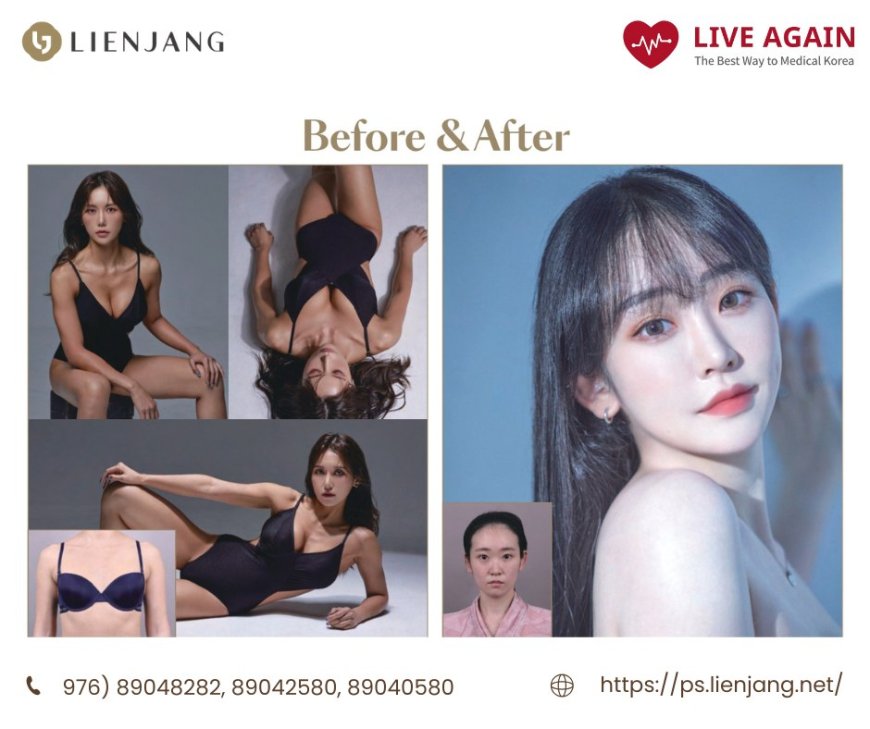 Хөхний мэс засал "Lienjang гоо сайхны мэс заслын эмнэлэг" Before & After