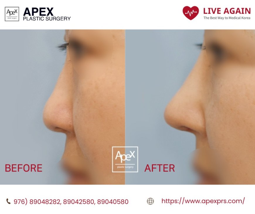 " Apex " Гоо сайхны мэс заслын эмнэлэг  Before & After 