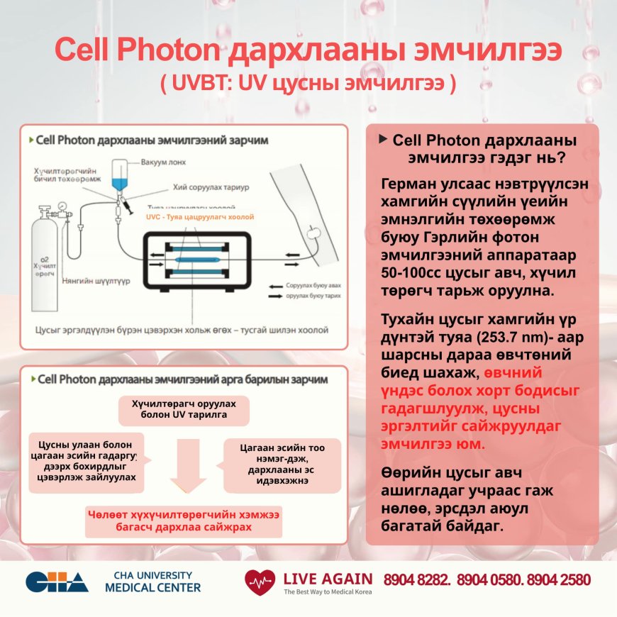 Cell Photon дархлааны эмчилгээ ( UVBT: UV цусны эмчилгээ )  CHA Medical center