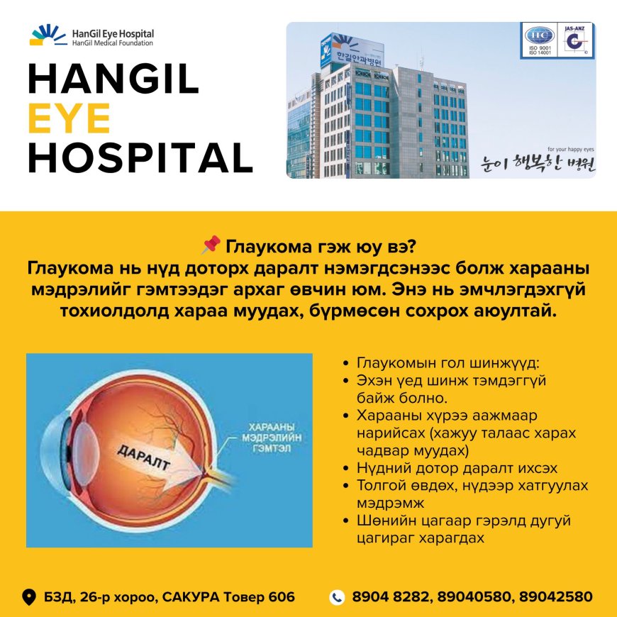 Глаукома гэж юу вэ?